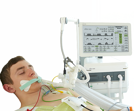 Аппарат ИВЛ ELISA 800 с интегрированным модулем EIT