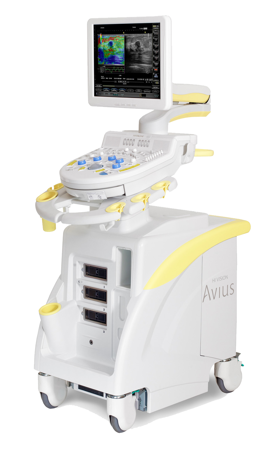 УЗИ аппарат Hitachi Hi Vision Avius