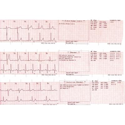 Электрокардиограф Fukuda FCP-7101 CardiMax