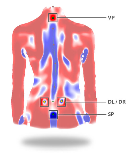 Система DIERS Formetric 4D (60 кадров)