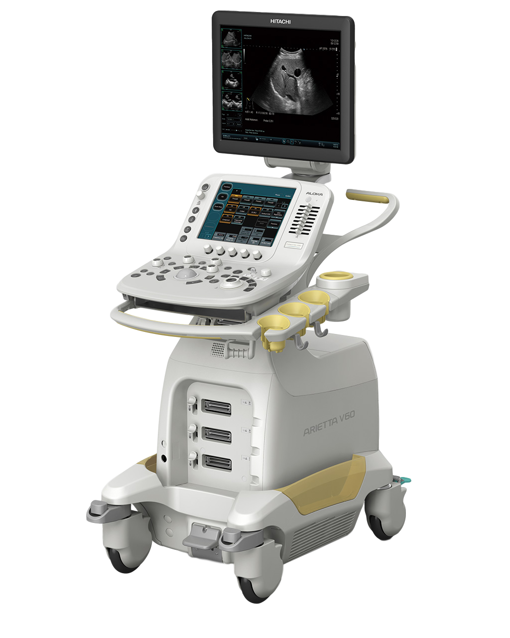 УЗИ аппарат Hitachi Arietta 60 (v60/s60)