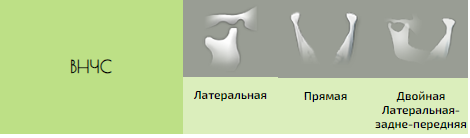 123.PNG