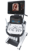 УЗИ-аппарат Samsung Medison HS70