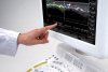 УЗИ сканер Hitachi Hi Vision Ascendus