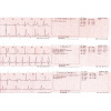Электрокардиограф Fukuda FCP-7101 CardiMax