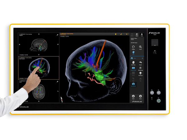 Интегрированная операционная Brainlab BUZZ Digital O.R.