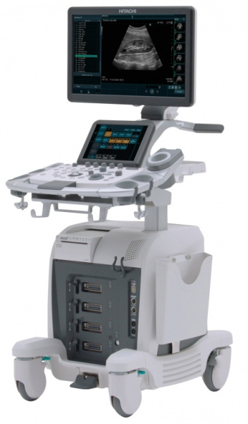 УЗИ аппарат Hitachi arietta 65